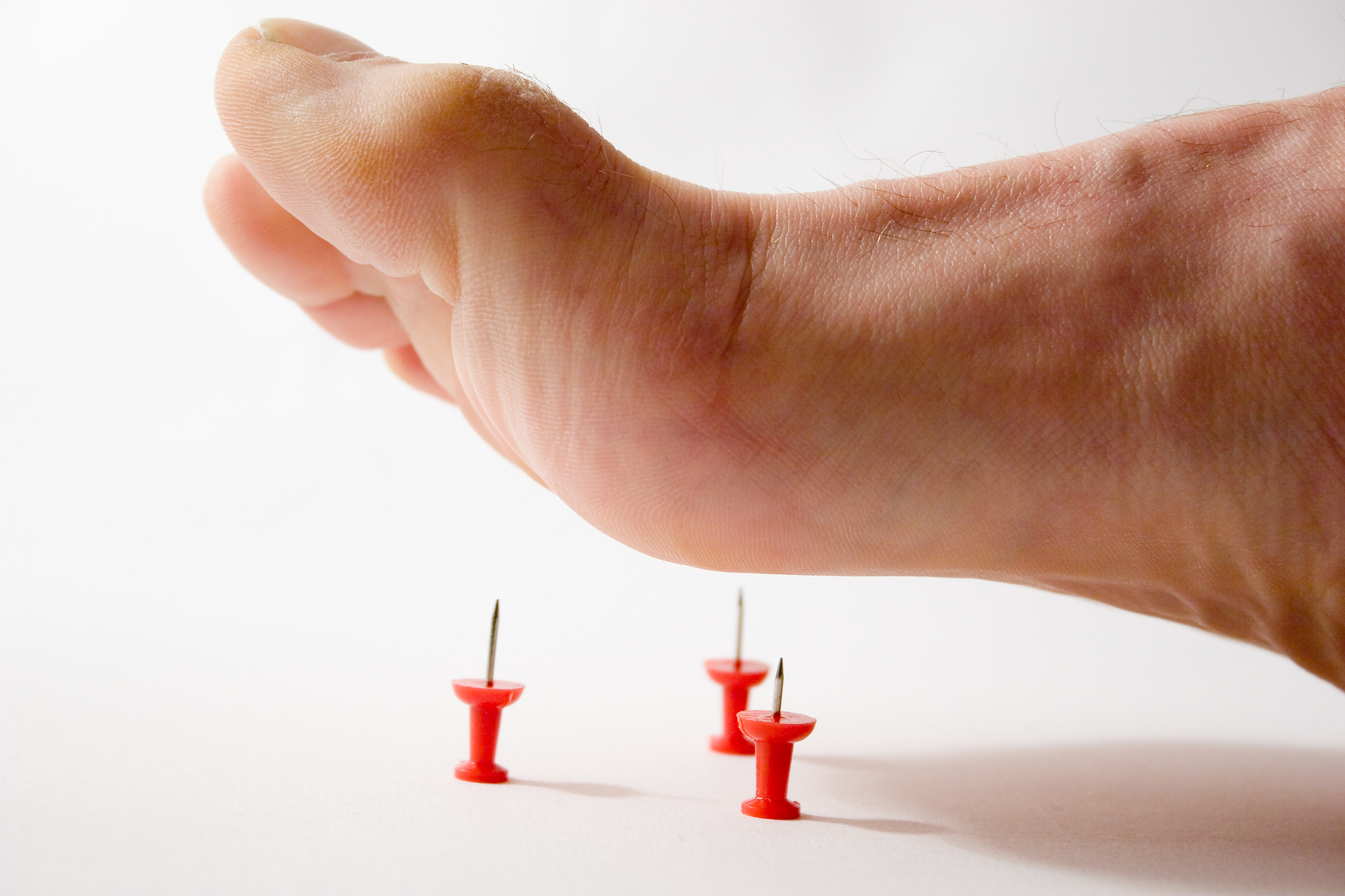 Podiatrists at Northern Foot Clinic are specialised at treating people with diabetic neuropathy